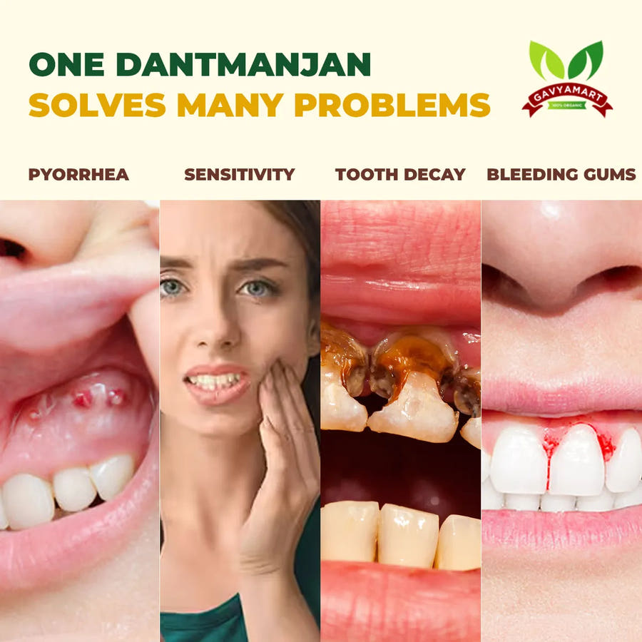 Gomay Dental Powder | Natural Tooth Powder | Herbal Oral Care | Herbal Teeth Cleaner | Natural Dental Care | Ayurvedic Dantmanjan | Best Dantmanjan India